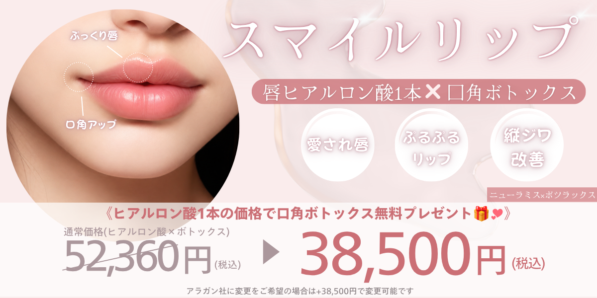 ボトックス